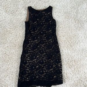 beautiful lace dress